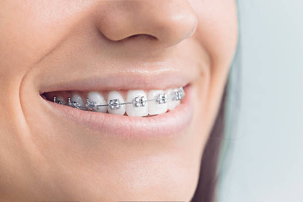 Why Choose Us for Your Dental Needs in Leonardtown, MD
